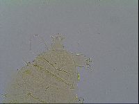 Multipseudechiniscus raneyi image