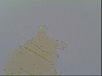 Multipseudechiniscus raneyi image