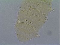 Multipseudechiniscus raneyi image