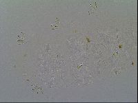 Multipseudechiniscus raneyi image
