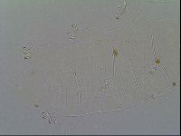 Multipseudechiniscus raneyi image
