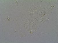 Multipseudechiniscus raneyi image
