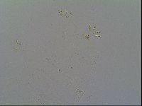 Multipseudechiniscus raneyi image