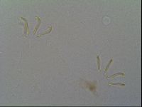 Multipseudechiniscus raneyi image