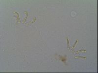 Multipseudechiniscus raneyi image