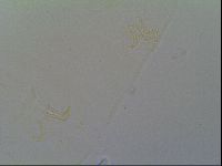 Multipseudechiniscus raneyi image