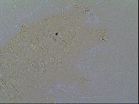 Multipseudechiniscus raneyi image
