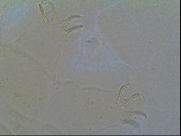 Multipseudechiniscus raneyi image