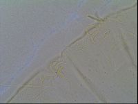 Multipseudechiniscus raneyi image