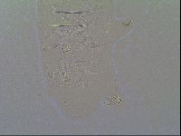 Multipseudechiniscus raneyi image