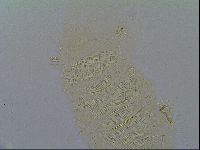 Multipseudechiniscus raneyi image