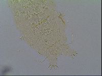 Multipseudechiniscus raneyi image