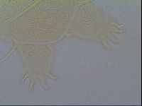 Multipseudechiniscus raneyi image