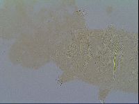 Multipseudechiniscus raneyi image
