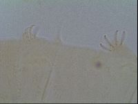 Multipseudechiniscus raneyi image