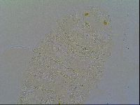 Multipseudechiniscus raneyi image
