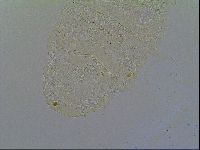 Multipseudechiniscus raneyi image
