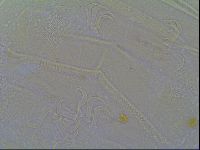 Multipseudechiniscus raneyi image