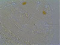Multipseudechiniscus raneyi image