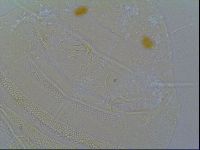 Multipseudechiniscus raneyi image