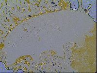 Multipseudechiniscus raneyi image