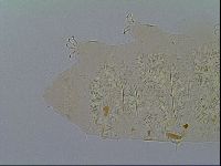Multipseudechiniscus raneyi image