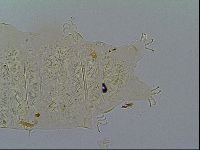 Multipseudechiniscus raneyi image