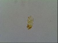 Multipseudechiniscus raneyi image