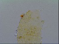 Multipseudechiniscus raneyi image