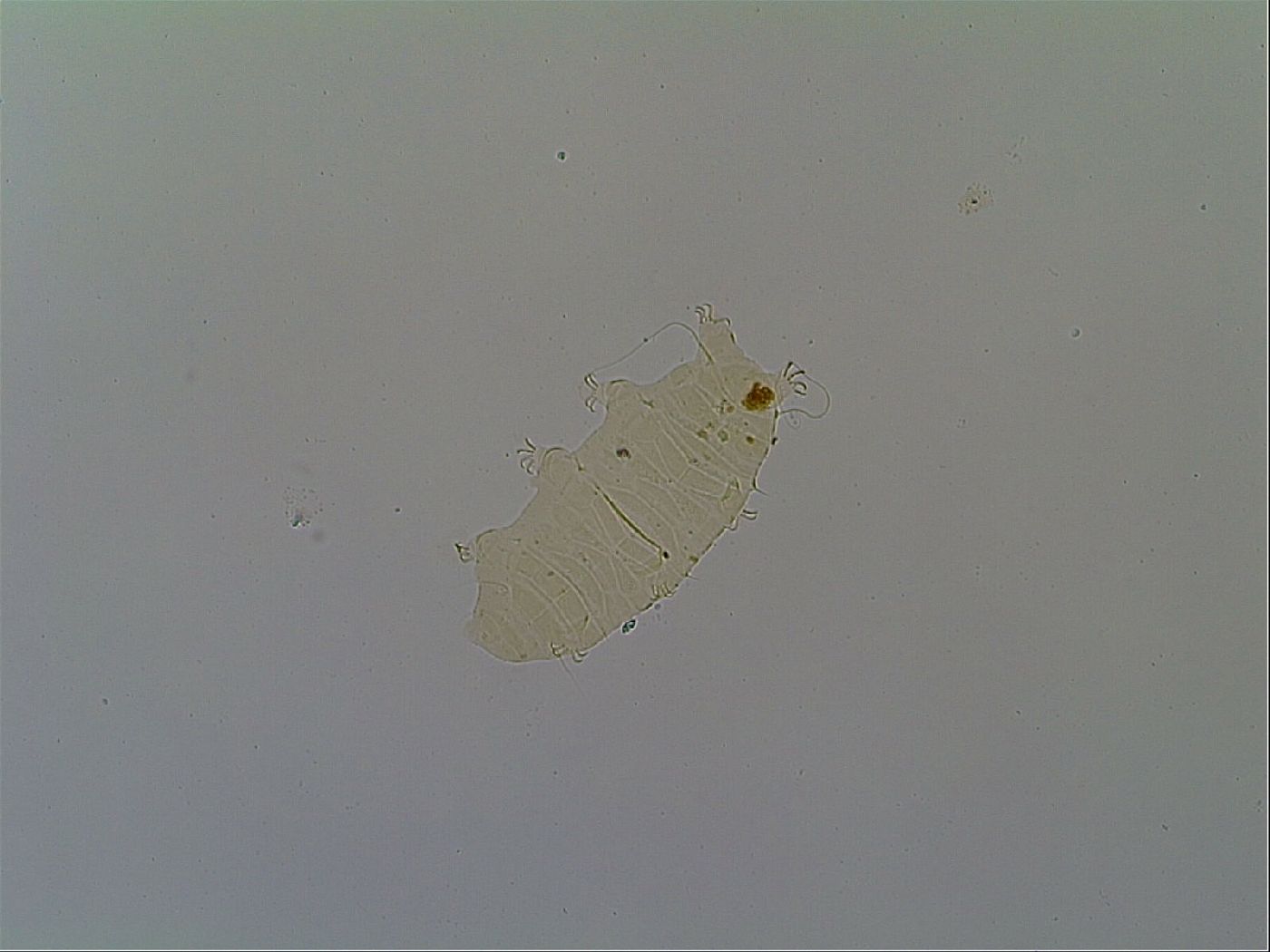 Multipseudechiniscus raneyi image