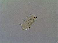 Multipseudechiniscus raneyi image