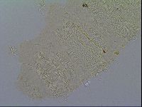 Multipseudechiniscus raneyi image