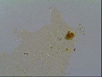 Multipseudechiniscus raneyi image