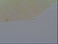 Multipseudechiniscus raneyi image