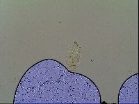 Multipseudechiniscus raneyi image