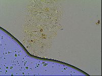 Multipseudechiniscus raneyi image