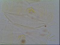 Multipseudechiniscus raneyi image