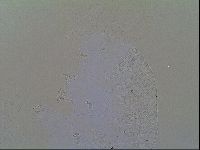 Multipseudechiniscus raneyi image