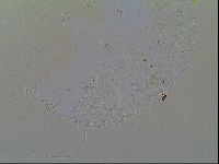 Multipseudechiniscus raneyi image