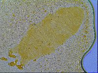 Multipseudechiniscus raneyi image