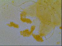 Multipseudechiniscus raneyi image