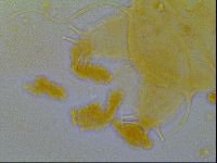 Multipseudechiniscus raneyi image