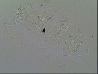 Multipseudechiniscus raneyi image