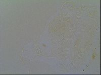 Multipseudechiniscus raneyi image