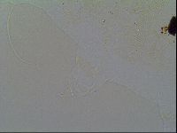 Multipseudechiniscus raneyi image