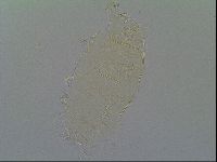 Pseudechiniscus ramazzottii image
