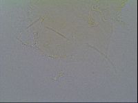 Pseudechiniscus ramazzottii image