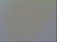 Pseudechiniscus ramazzottii facettalis image