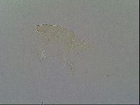 Pseudechiniscus ramazzottii image