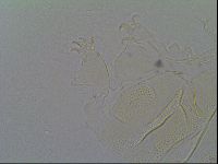 Pseudechiniscus ramazzottii image